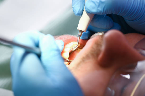Best Emergency Treatment for Toothache in Mendon, IL
