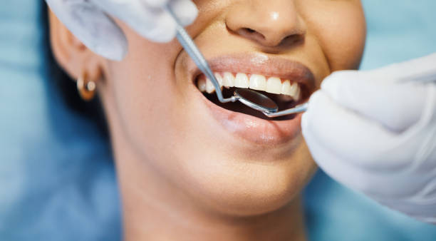 Best Same-Day Emergency Dentist in Mendon, IL